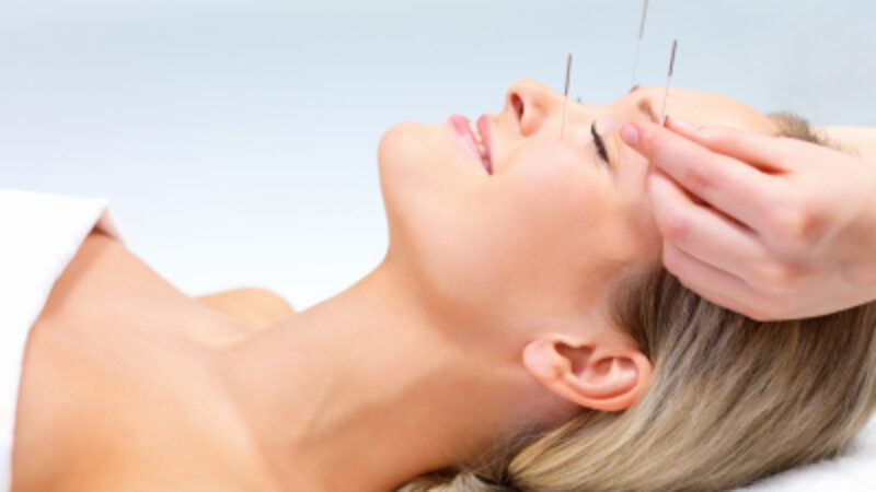 Acupuncture: The Hottest Wrinkle Treatment