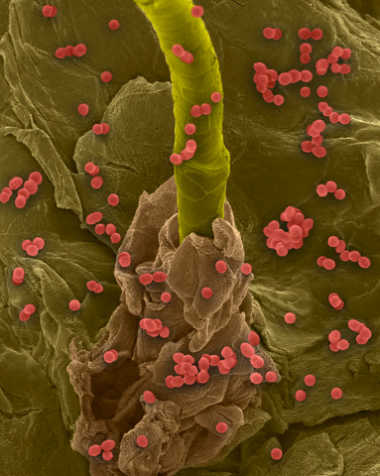 Bacteria found on skin