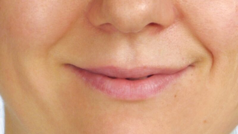 3 Tips for Lovely Lips
