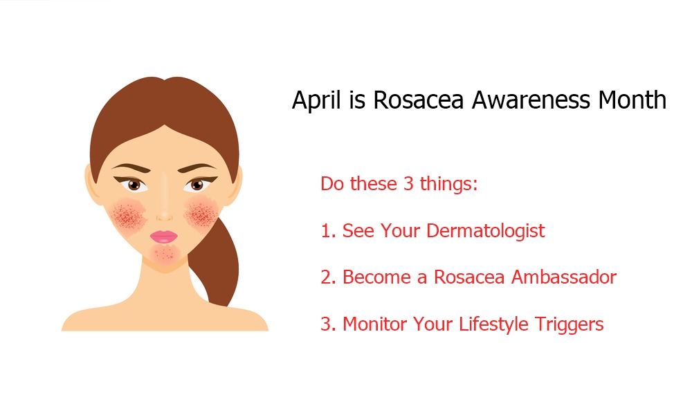 April is Rosacea Awareness Month